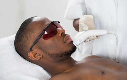 Do’s and Don’ts After Laser Hair Removal